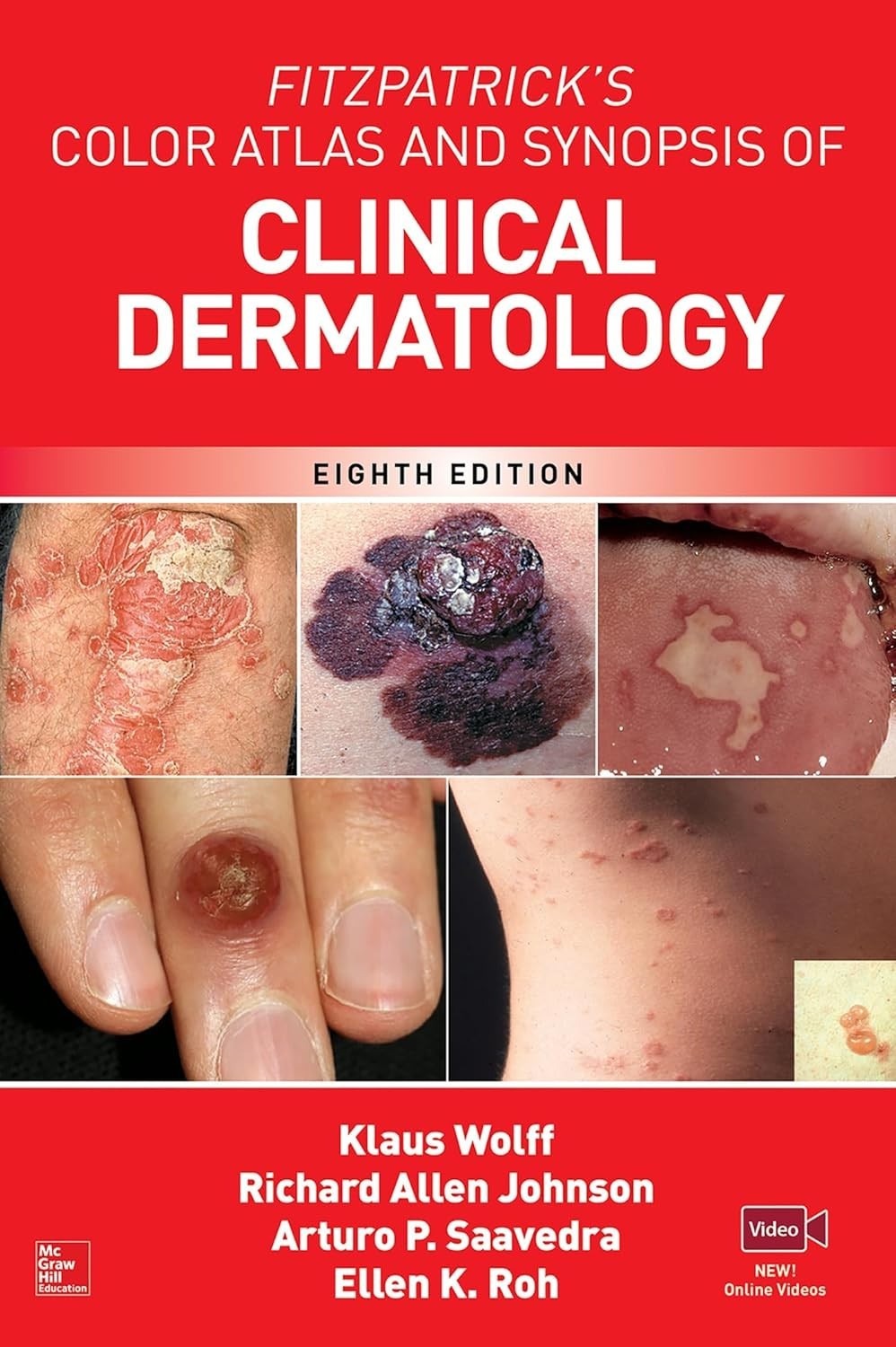Fitzpatrick’s Color Atlas & Synopsis of Clinical Dermatology 8th Edition