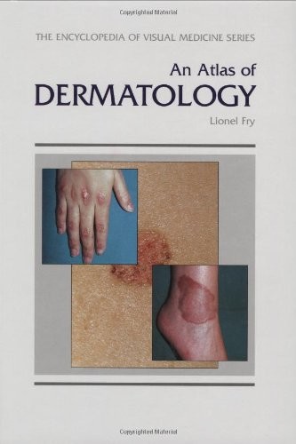 An Atlas of Dermatology Encycl – GOOD