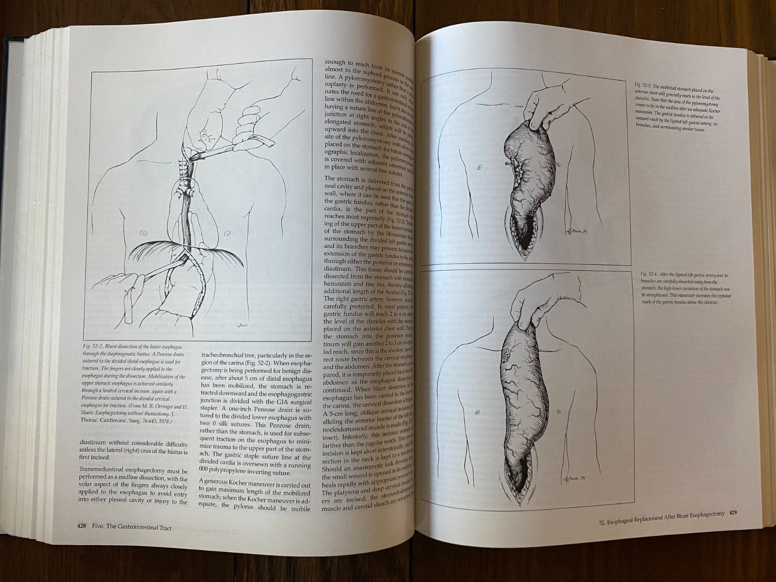 Mastery of Surgery 1984 Lloyd M Nyhus Robert Baker Vol 1 & 2 HC Slipcase