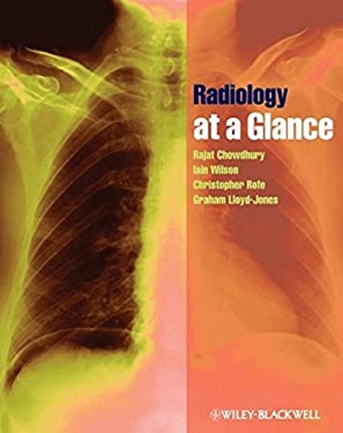Radiology at a Glance Paperback