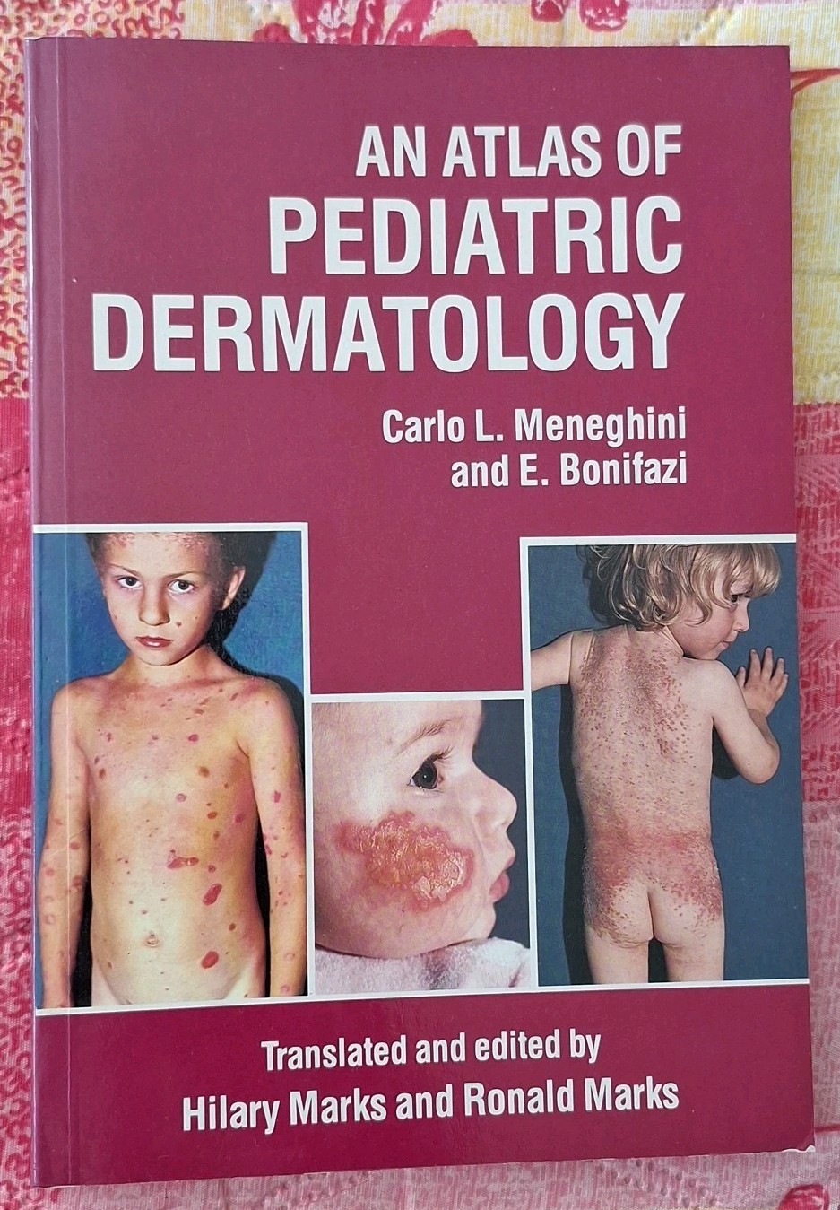 An Atlas Of Pediatric Dermatology Meneghini & Bonifazi Textbook Paperback