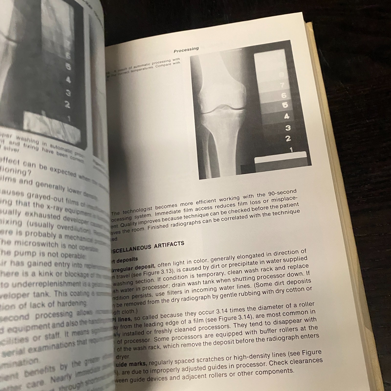 Formulating X-Ray Techniques by John B. Cahoon (Hardcover)