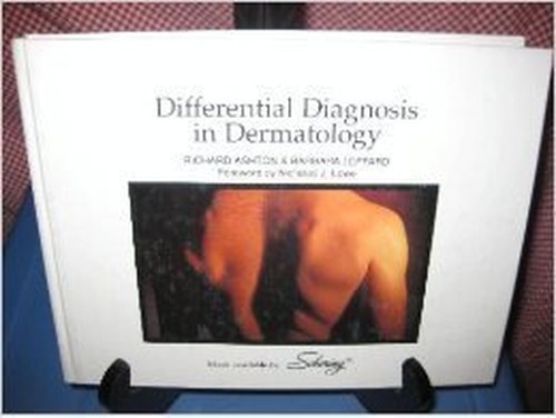Differential Diagnosis in Dermatolo…, Ashton, Richard