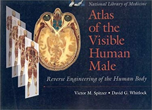 The National Library of Medicine’s Atlas of the Visible Human Mal