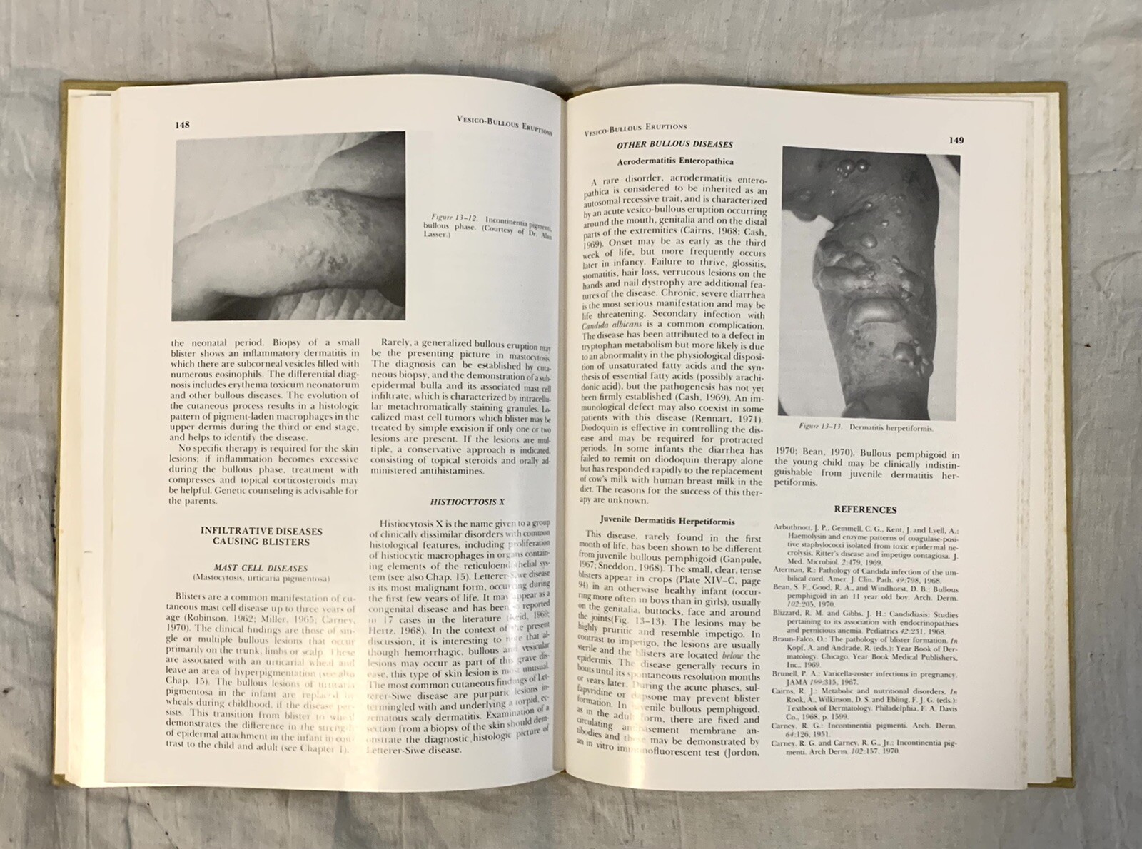 NEONATAL DERMATOLOGY, MAJOR PROBLEMS IN CLINICAL PEDIATRICS by Solomon & Esterly