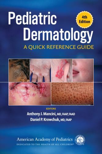 Pediatric Dermatology: A Quick Reference Guide by