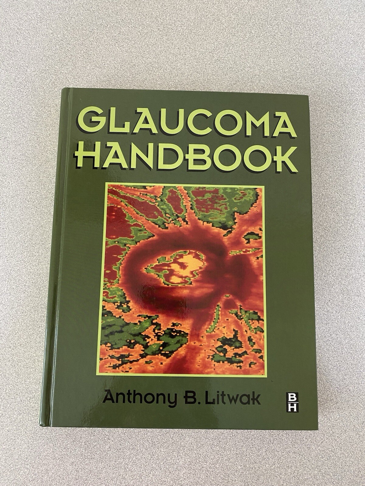 Glaucoma Handbook by Anthony B. Litwak, 2001 edition, Butterworth-Heinemann
