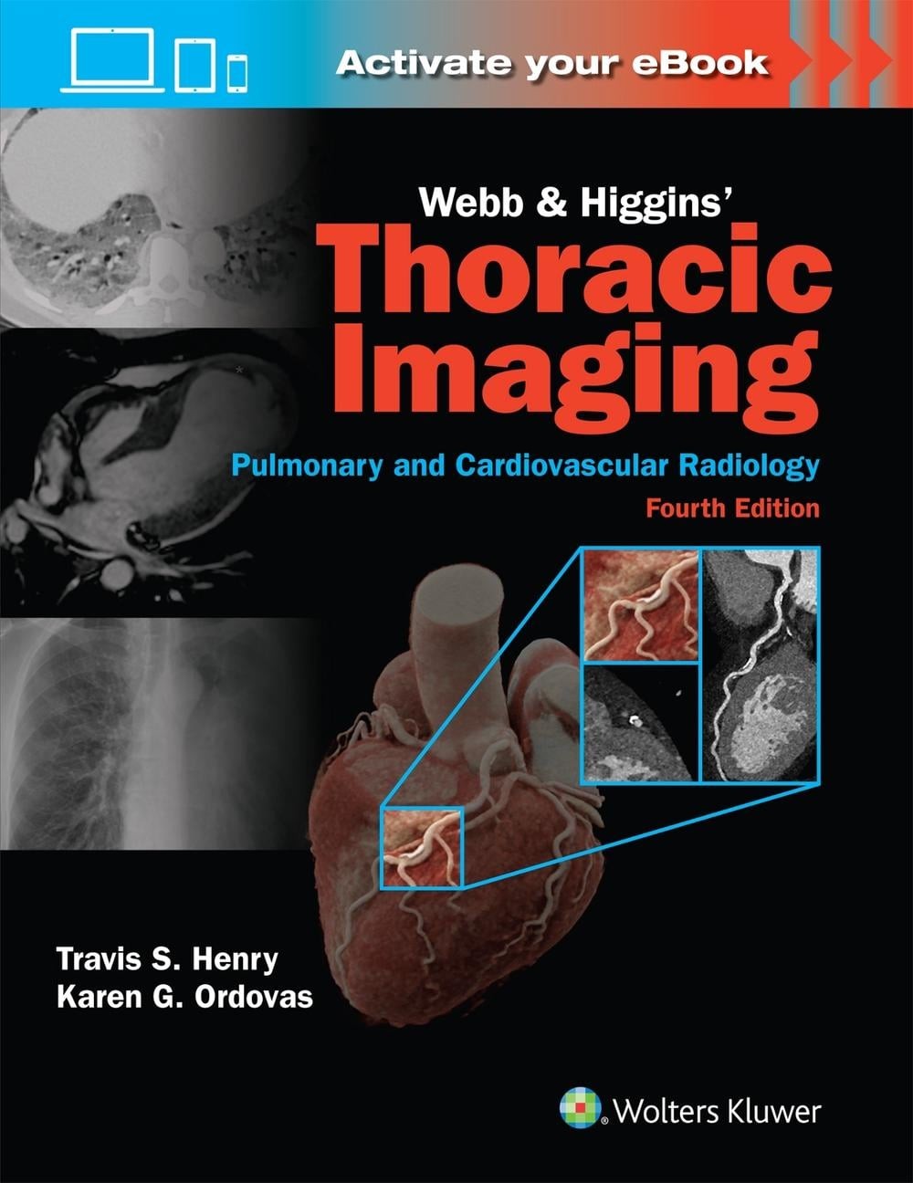 Webb & Higgins Thoracic Imaging: Print + eBook with Multimedia by KAREN GOMES OR